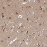 SRGAP3 Antibody in Immunohistochemistry (IHC)