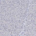 SRGAP3 Antibody in Immunohistochemistry (IHC)