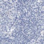 SRGAP3 Antibody in Immunohistochemistry (IHC)