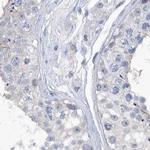 SRGAP3 Antibody in Immunohistochemistry (IHC)