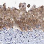 SRGAP3 Antibody in Immunohistochemistry (IHC)