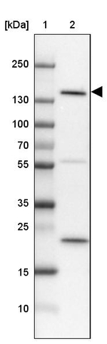 SRGAP3 Antibody in Western Blot (WB)