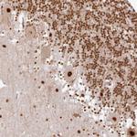 SYT15 Polyclonal Antibody