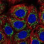 PGAM5 Polyclonal Antibody