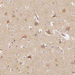 PGAM5 Antibody in Immunohistochemistry (IHC)