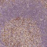 PGAM5 Antibody in Immunohistochemistry (IHC)
