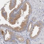 GRINA Polyclonal Antibody