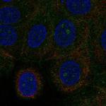 GRINA Polyclonal Antibody