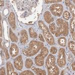 GRINA Antibody in Immunohistochemistry (Paraffin) (IHC (P))