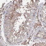 GRINA Antibody in Immunohistochemistry (Paraffin) (IHC (P))