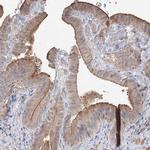GRINA Antibody in Immunohistochemistry (IHC)