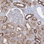 TMEM139 Polyclonal Antibody