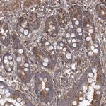 TMEM139 Antibody in Immunohistochemistry (Paraffin) (IHC (P))