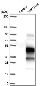 TMEM139 Antibody in Western Blot (WB)