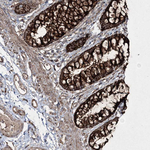 GRSF1 Antibody in Immunohistochemistry (Paraffin) (IHC (P))