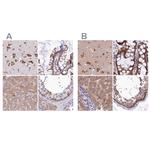 QARS Antibody in Immunohistochemistry (IHC)