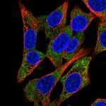 QARS Polyclonal Antibody