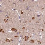 QARS Antibody in Immunohistochemistry (IHC)