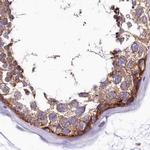 QARS Antibody in Immunohistochemistry (IHC)