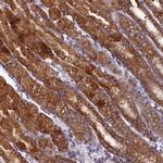 QARS Antibody in Immunohistochemistry (IHC)