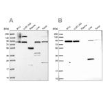QARS Antibody in Western Blot (WB)