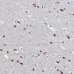 ABHD10 Polyclonal Antibody