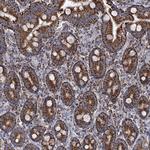 ABHD10 Antibody in Immunohistochemistry (Paraffin) (IHC (P))