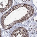 ABHD10 Antibody in Immunohistochemistry (Paraffin) (IHC (P))