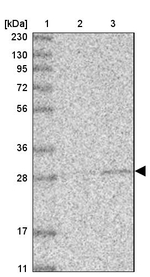 ABHD10 Antibody in Western Blot (WB)