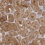 RNF7 Antibody in Immunohistochemistry (Paraffin) (IHC (P))