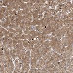 RNF7 Antibody in Immunohistochemistry (Paraffin) (IHC (P))