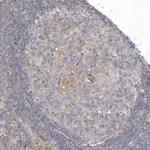RNF7 Antibody in Immunohistochemistry (Paraffin) (IHC (P))
