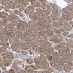 RNF7 Antibody in Immunohistochemistry (Paraffin) (IHC (P))