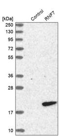 RNF7 Antibody in Western Blot (WB)