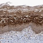 ARMC8 Polyclonal Antibody