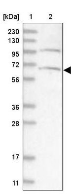 ARMC8 Antibody in Western Blot (WB)