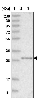 NIT2 Antibody in Western Blot (WB)
