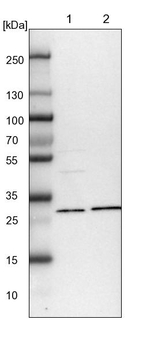 NIT2 Antibody in Western Blot (WB)