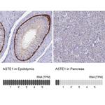ASTE1 Polyclonal Antibody
