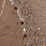 C10orf113 Polyclonal Antibody