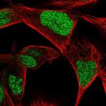 CGGBP1 Polyclonal Antibody