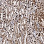 CGGBP1 Antibody in Immunohistochemistry (Paraffin) (IHC (P))