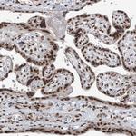 CGGBP1 Antibody in Immunohistochemistry (Paraffin) (IHC (P))