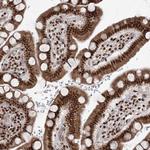 CGGBP1 Antibody in Immunohistochemistry (Paraffin) (IHC (P))
