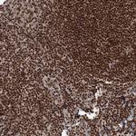 CGGBP1 Antibody in Immunohistochemistry (Paraffin) (IHC (P))