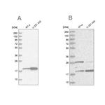 CGGBP1 Antibody in Western Blot (WB)