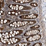 MMAA Antibody in Immunohistochemistry (Paraffin) (IHC (P))