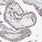 FAM44A Antibody in Immunohistochemistry (Paraffin) (IHC (P))