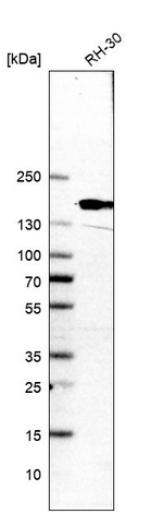 NCAPD2 Antibody in Western Blot (WB)