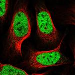 R3HCC1L Antibody in Immunocytochemistry (ICC/IF)